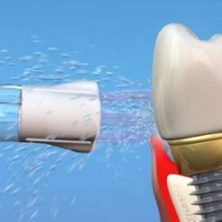 Beste Pirce 😍 Waterpik PS-100E Plaque Seeker Tips - Opzetstukken Voor Waterflossers - 2 Stuks - Zilver 🧨 -La Roche Shop 550x275 2