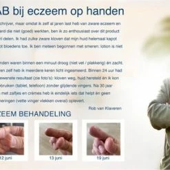 Groothandel π Gloves In A Bottle (GIAB) | Beschermende, Hydraterende En Herstellende Lotion | Eczeem, Droge Huid, Psoriasis |2 X 240 Ml Voordeelverpakking π€© 9 Groothandel π Gloves In A Bottle (GIAB) | Beschermende, Hydraterende En Herstellende Lotion | Eczeem, Droge Huid, Psoriasis |2 X 240 Ml Voordeelverpakking π€© -La Roche Shop 550x287 2