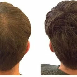 Goedkoop 🧨 IMPERIO Premium Haarvezels Donkerbruin - Kaalheid Mannen - Alopecia Vrouwen - 100% Onzichtbaar 🎉 -La Roche Shop 550x326