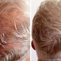 Goedkoop 🧨 IMPERIO Premium Haarvezels Donkerbruin - Kaalheid Mannen - Alopecia Vrouwen - 100% Onzichtbaar 🎉 -La Roche Shop 550x363 1