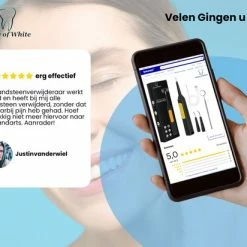 Gloednieuw ⭐ Glory Of White Professionele Tandsteen Verwijderaar - Elektrisch Tandplak Verwijderen - Tanden Polijsten 🥰 -La Roche Shop 550x412 19