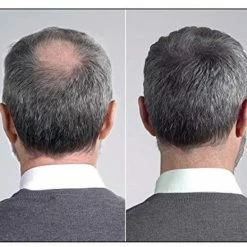 Goedkoop 🧨 IMPERIO Premium Haarvezels Donkerbruin - Kaalheid Mannen - Alopecia Vrouwen - 100% Onzichtbaar 🎉 -La Roche Shop 550x465 2