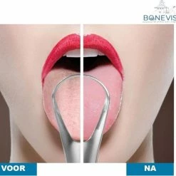Coupon ❤️ Bone Vista RVS Tongschraper Voor Mondverzorging – 4 Stuks – Tongreiniger, Tongborstel & Tong Schraper – Duurzaam & Herbruikbaar 🤩 13 Coupon ❤️ Bone Vista RVS Tongschraper Voor Mondverzorging – 4 Stuks – Tongreiniger, Tongborstel & Tong Schraper – Duurzaam & Herbruikbaar 🤩 -La Roche Shop 550x489 7