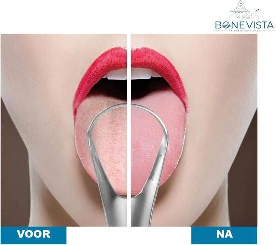 Coupon ❤️ Bone Vista RVS Tongschraper Voor Mondverzorging – 4 Stuks – Tongreiniger, Tongborstel & Tong Schraper – Duurzaam & Herbruikbaar 🤩 6 Coupon ❤️ Bone Vista RVS Tongschraper Voor Mondverzorging – 4 Stuks – Tongreiniger, Tongborstel & Tong Schraper – Duurzaam & Herbruikbaar 🤩 - Afbeelding 4