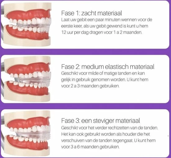 Goedkoopste π Gratyfied Rechte Tanden Zonder Beugel - Nachtbeugel Rechte Tanden - Rechte Tanden Bitje π 4 Goedkoopste π Gratyfied Rechte Tanden Zonder Beugel - Nachtbeugel Rechte Tanden - Rechte Tanden Bitje π - Afbeelding 2