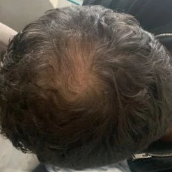 Beste deal π₯ Ouini's Olie Ouini's Knoflookolie- Haar Uitval - Haargroei Olie - Knoflook Olie - Eczeem- Acne - Psoriasis - Rosacea - Alopecia - Baardgroei π 16 Beste deal π₯ Ouini's Olie Ouini's Knoflookolie- Haar Uitval - Haargroei Olie - Knoflook Olie - Eczeem- Acne - Psoriasis - Rosacea - Alopecia - Baardgroei π -La Roche Shop 550x516 3