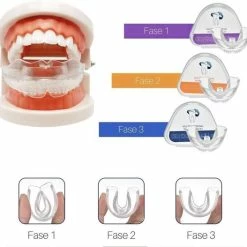 Goedkoopste π Gratyfied Rechte Tanden Zonder Beugel - Nachtbeugel Rechte Tanden - Rechte Tanden Bitje π 13 Goedkoopste π Gratyfied Rechte Tanden Zonder Beugel - Nachtbeugel Rechte Tanden - Rechte Tanden Bitje π -La Roche Shop 550x527 2
