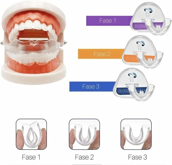 Goedkoopste π Gratyfied Rechte Tanden Zonder Beugel - Nachtbeugel Rechte Tanden - Rechte Tanden Bitje π 8 Goedkoopste π Gratyfied Rechte Tanden Zonder Beugel - Nachtbeugel Rechte Tanden - Rechte Tanden Bitje π - Afbeelding 6