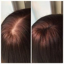 Goedkoop 🧨 IMPERIO Premium Haarvezels Donkerbruin - Kaalheid Mannen - Alopecia Vrouwen - 100% Onzichtbaar 🎉 -La Roche Shop 550x550 109