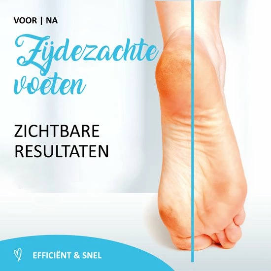 Nieuw π₯° Helperfect Eelt Verwijderaar - Effectieve Eeltverwijderaar Voor Voeten En Handen - Voetvijl π 9 Nieuw π₯° Helperfect Eelt Verwijderaar - Effectieve Eeltverwijderaar Voor Voeten En Handen - Voetvijl π - Afbeelding 7