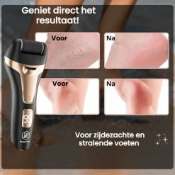 Hete verkoop 🔥 Beeperfect® Elektrische Eeltverwijderaar - Draadloos & Oplaadbaar - LED Lampje - Voetvijl - Eeltvijl - Gratis Pedicure Set - ⭐ -La Roche Shop 550x550 227