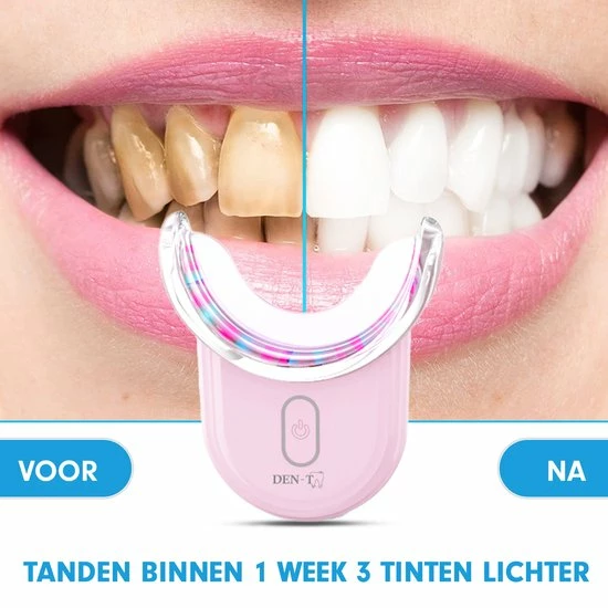 Uitgang ๐ DEN-T® U-shape PRO - Tandenbleekset - 32 LED - Zonder Peroxide - Tandenbleken - Teeth Whitening - Roze - ๐ฅ 9 Uitgang ๐ DEN-T® U-shape PRO - Tandenbleekset - 32 LED - Zonder Peroxide - Tandenbleken - Teeth Whitening - Roze - ๐ฅ - Afbeelding 7
