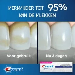 Aanbiedingen π Crest 3D White Brilliance Toothpaste - Tandpasta Voor Wittere Tanden En Intensieve Bleek- En Glazuurbehandeling - Tandpasta Whitening - 3 X 75 Ml π 8 Aanbiedingen π Crest 3D White Brilliance Toothpaste - Tandpasta Voor Wittere Tanden En Intensieve Bleek- En Glazuurbehandeling - Tandpasta Whitening - 3 X 75 Ml π -La Roche Shop 550x550 388
