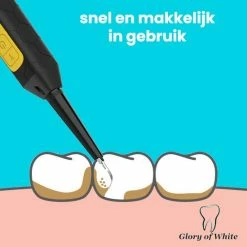 Gloednieuw ⭐ Glory Of White Professionele Tandsteen Verwijderaar - Elektrisch Tandplak Verwijderen - Tanden Polijsten 🥰 -La Roche Shop 550x550 613