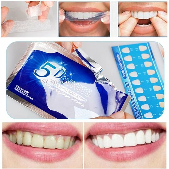 Begroting π₯° 5D White Whitening Strips | Tanden Bleken Strips | Tanden Bleken | Tanden Strips | Wit Gebit | Witte Tanden | Tandenblekers | Tandenbleekset | Tandenbleek Strips | Geen Crest | Crest Whitestrips | Wittere Tanden π 5 Begroting π₯° 5D White Whitening Strips | Tanden Bleken Strips | Tanden Bleken | Tanden Strips | Wit Gebit | Witte Tanden | Tandenblekers | Tandenbleekset | Tandenbleek Strips | Geen Crest | Crest Whitestrips | Wittere Tanden π - Afbeelding 3