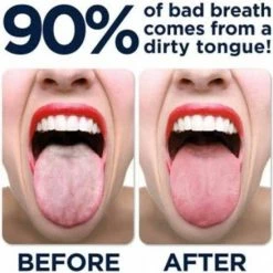 Uitgang 😀 Merkloos Tongreiniger - Koper (1 Stuks) 🥰 -La Roche Shop 550x557 8