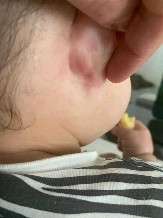 Beste deal π₯ Ouini's Olie Ouini's Knoflookolie- Haar Uitval - Haargroei Olie - Knoflook Olie - Eczeem- Acne - Psoriasis - Rosacea - Alopecia - Baardgroei π 4 Beste deal π₯ Ouini's Olie Ouini's Knoflookolie- Haar Uitval - Haargroei Olie - Knoflook Olie - Eczeem- Acne - Psoriasis - Rosacea - Alopecia - Baardgroei π - Afbeelding 2