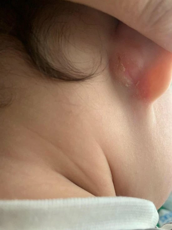 Beste deal π₯ Ouini's Olie Ouini's Knoflookolie- Haar Uitval - Haargroei Olie - Knoflook Olie - Eczeem- Acne - Psoriasis - Rosacea - Alopecia - Baardgroei π 5 Beste deal π₯ Ouini's Olie Ouini's Knoflookolie- Haar Uitval - Haargroei Olie - Knoflook Olie - Eczeem- Acne - Psoriasis - Rosacea - Alopecia - Baardgroei π - Afbeelding 3