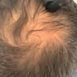 Beste deal π₯ Ouini's Olie Ouini's Knoflookolie- Haar Uitval - Haargroei Olie - Knoflook Olie - Eczeem- Acne - Psoriasis - Rosacea - Alopecia - Baardgroei π 17 Beste deal π₯ Ouini's Olie Ouini's Knoflookolie- Haar Uitval - Haargroei Olie - Knoflook Olie - Eczeem- Acne - Psoriasis - Rosacea - Alopecia - Baardgroei π -La Roche Shop 550x812 1